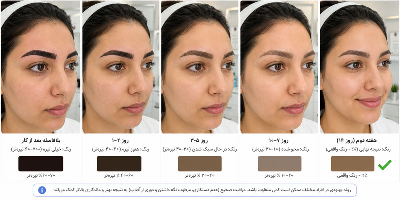 مراقبت بعد از میکروبلیدینگ
