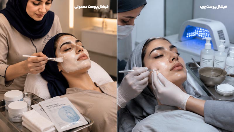فیشیال پوست چرب و مستعد آکنه