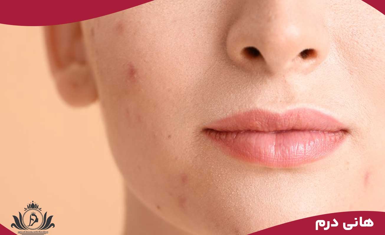 آموزشگاه هانی درم 