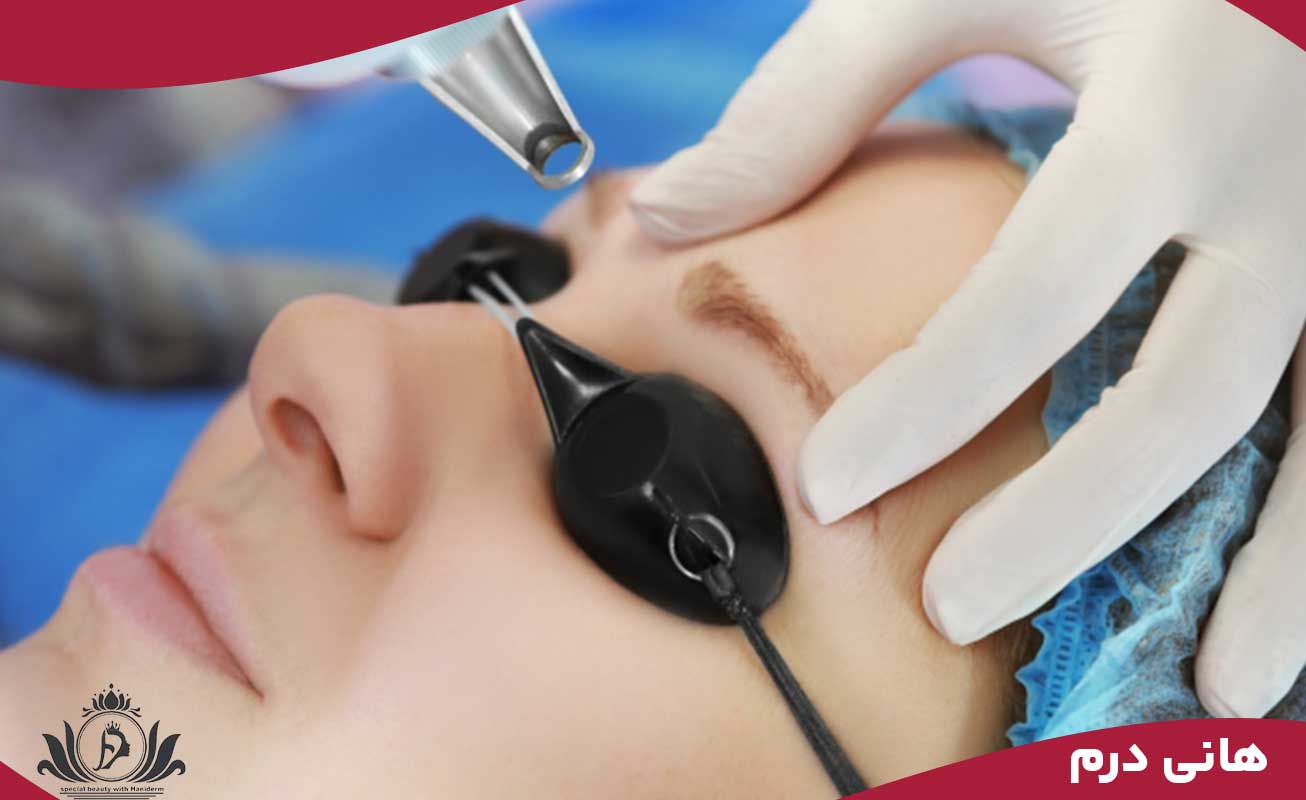 ارائه مشاوره رایگان برای بازاریابی