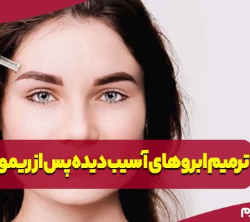 اصلاح و ترمیم ابروهای آسیب دیده پس از ریموو