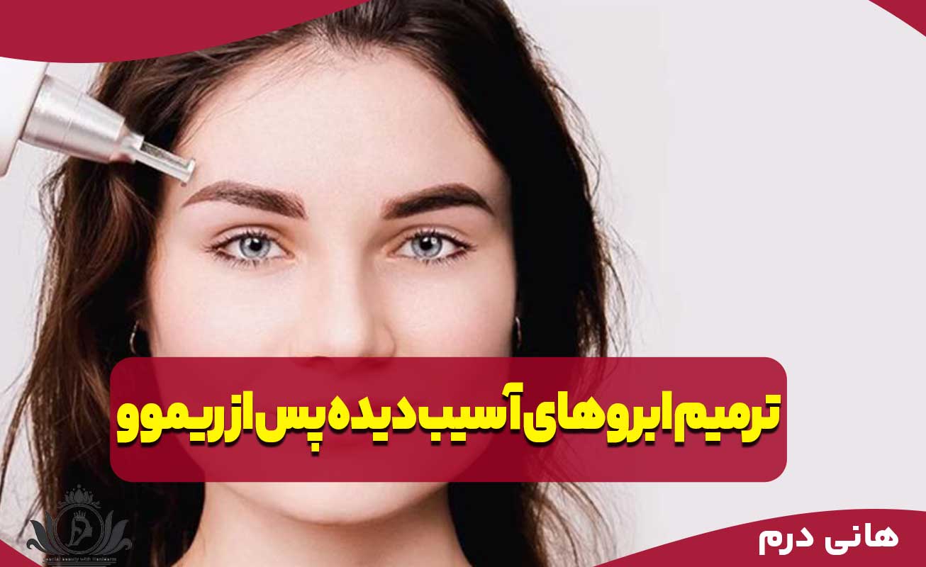 اصلاح و ترمیم ابروهای آسیب دیده پس از ریموو