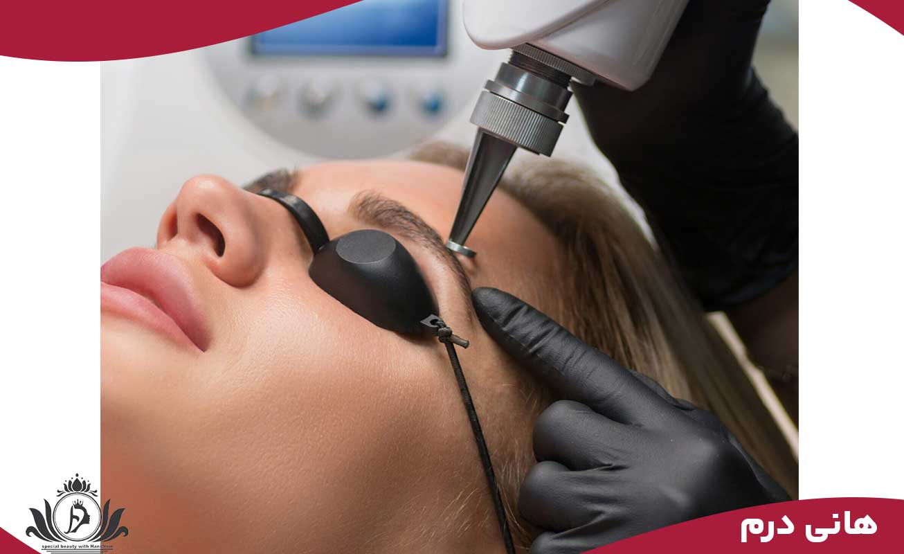 پارامترهای لیزر و تنظیمات دستگاه
