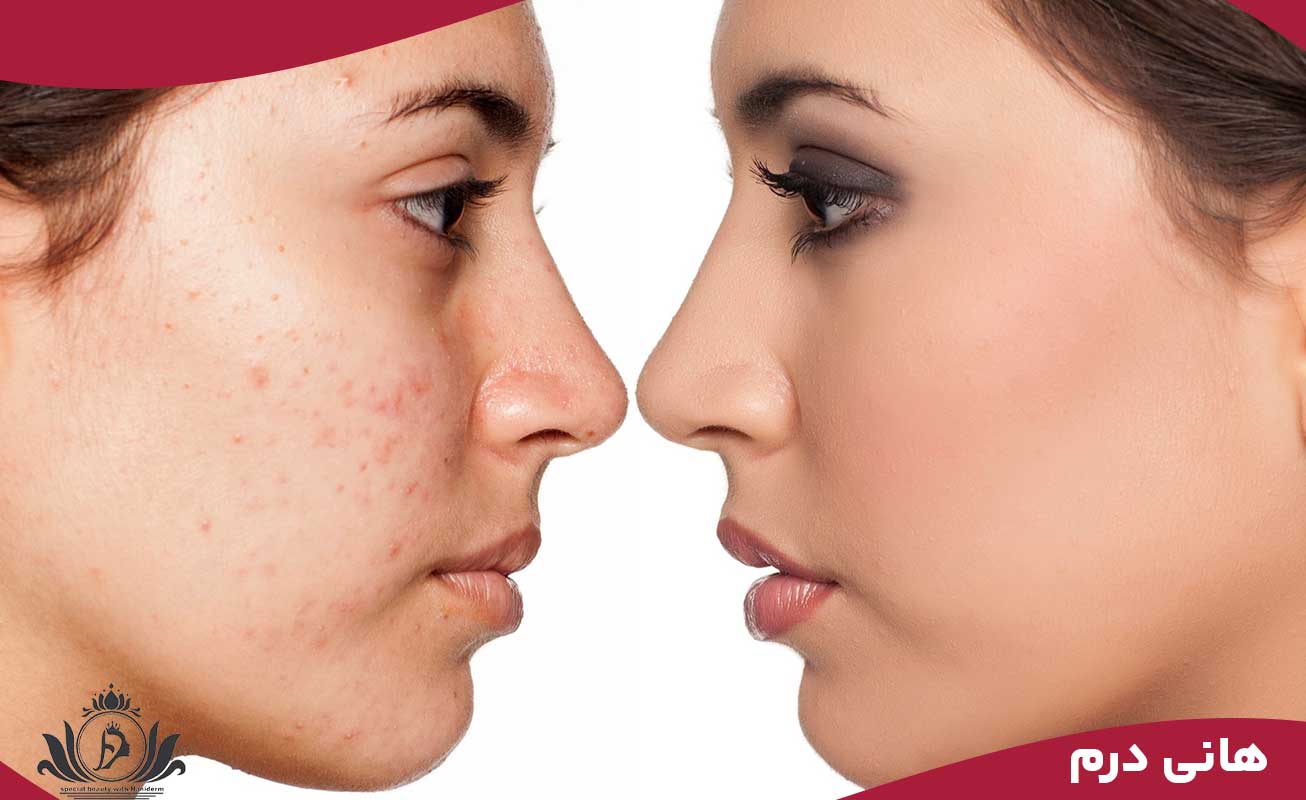 کاهش استرس 