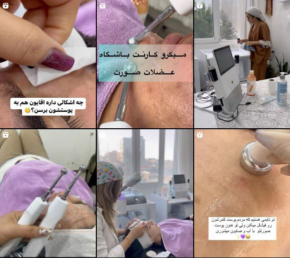 نمونه معرفی خدمات پاکسازی پوست
