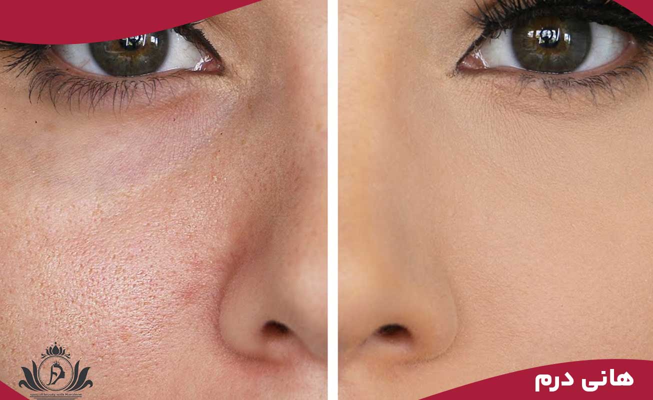 خدمات پاکسازی با ارائه تخفیف‌های ویژه