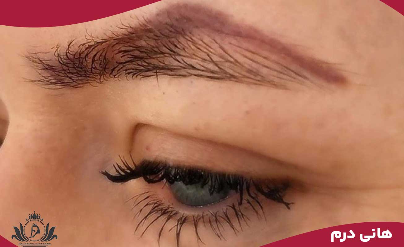 انواع مواد شیمیایی مورد استفاده در ریموو ابرو