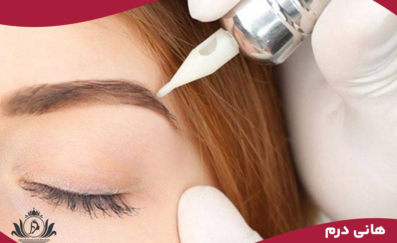  روش‌های مختلف ریموو