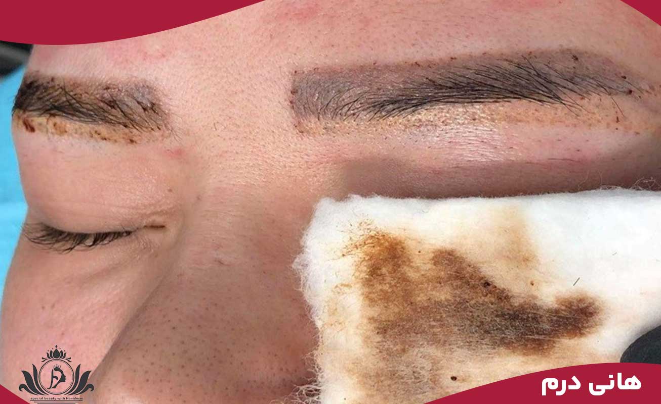 نحوه صحیح استفاده از مواد شیمیایی