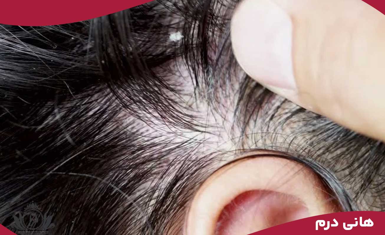 آیا اسکالپ سر برای پوست‌های حساس خطرناک است؟