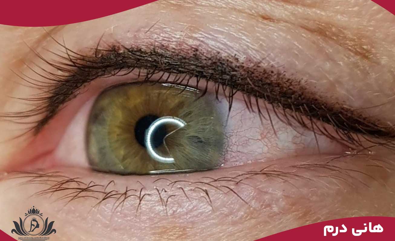 ماندگاری بیشتر بن مژه