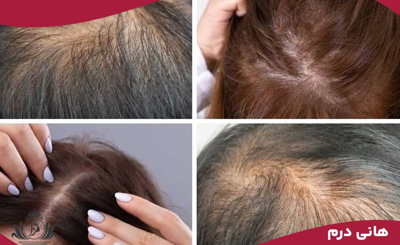 تاریخچه و تکامل تکنیک‌های اسکالپ