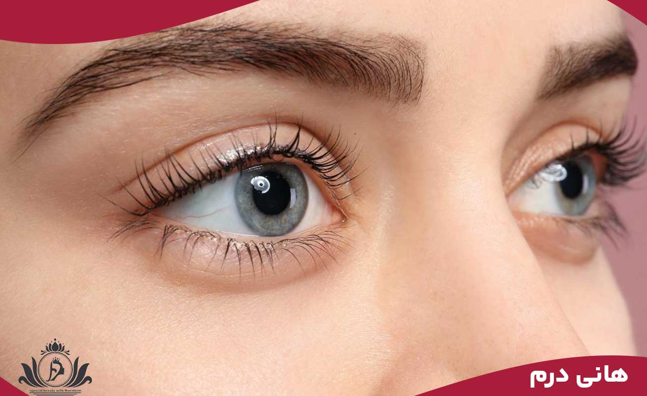 اجرای جدیدترین تکنیک‌های بن مژه