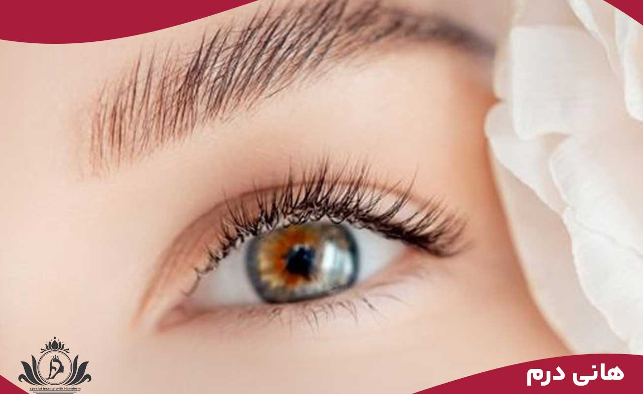 نکات طلایی مراقبتی پس‌از بن مژه