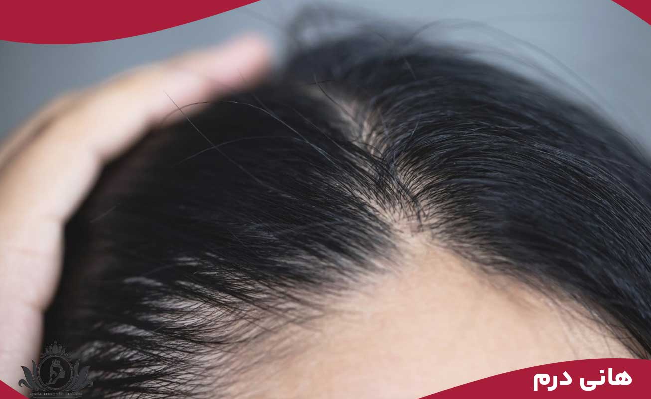 چرا بعضی از افراد نتایج ضعیفی از اسکالپ می‌گیرند؟