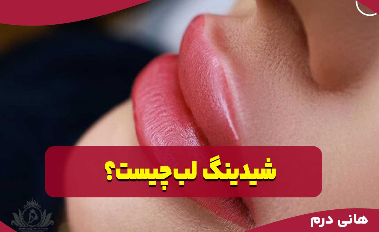 شیدینگ لب چیست
