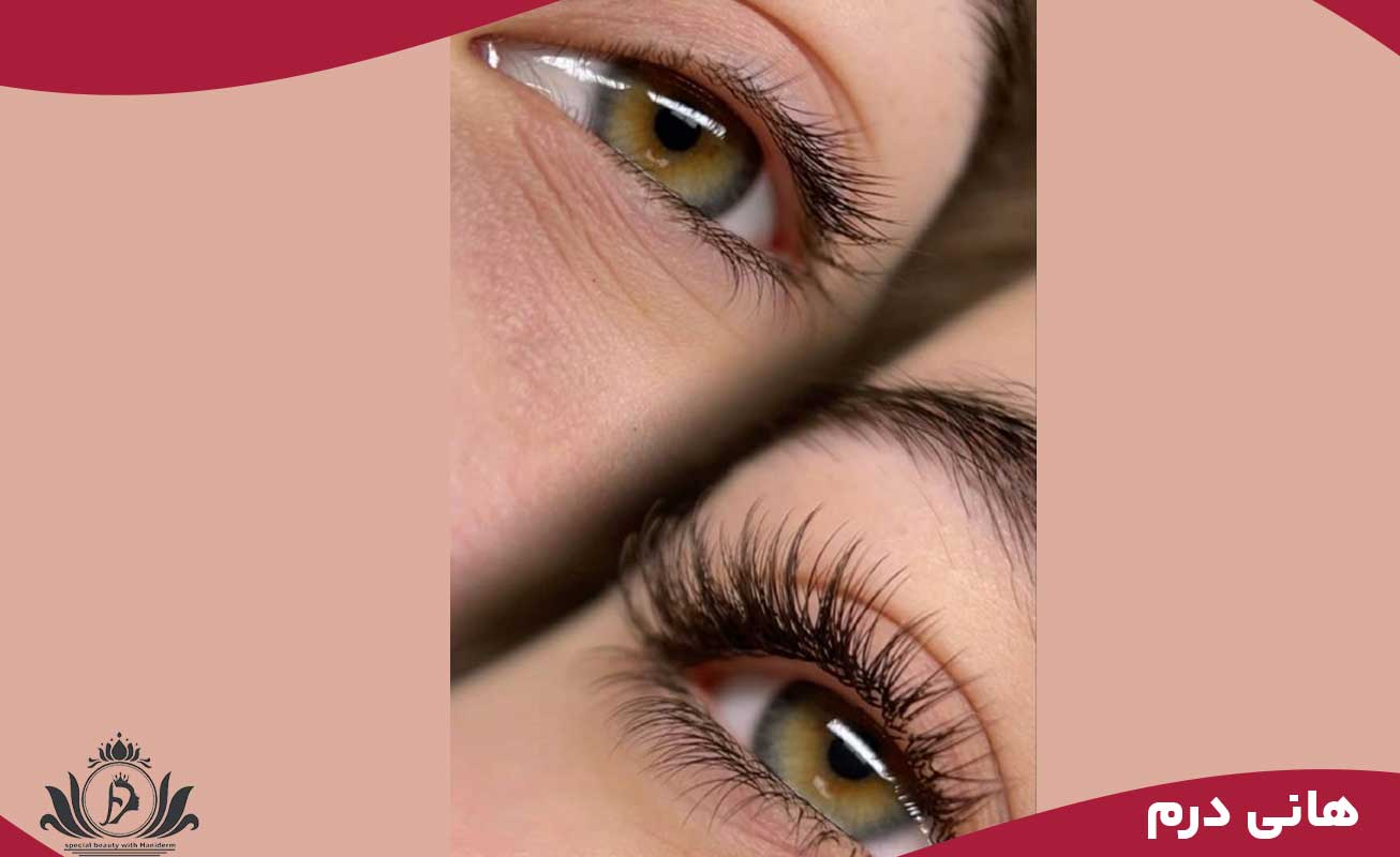 دوره آموزش ریموو خط چشم