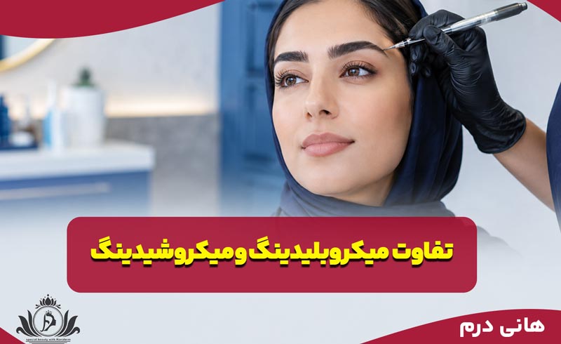 تفاوت میکروبلیدینگ و میکروشیدینگ