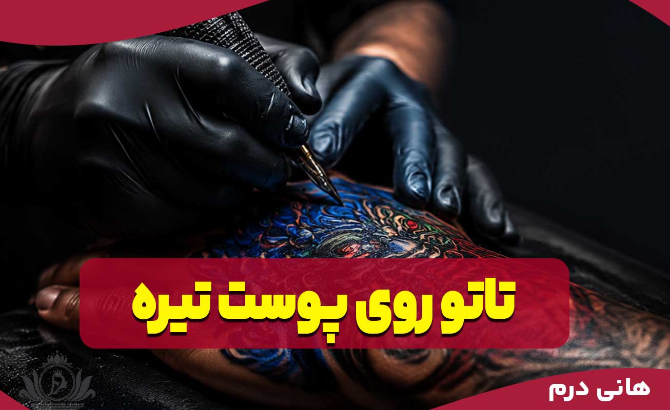 تاتو روی پوست تیره
