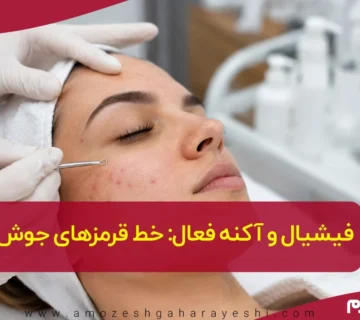 فیشیال برای آکنه فعال